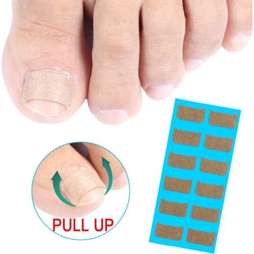 36/72/120Pcs Nail Correct Patches Effective Paronychia Recover Ingrown Toenail Correction Stickers Pedicure Corrector Tools