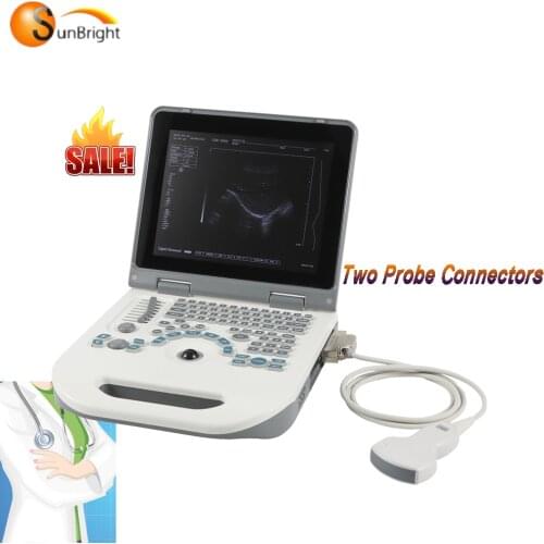 Machine ultrasound chinese manufacturer testing machine echo machine