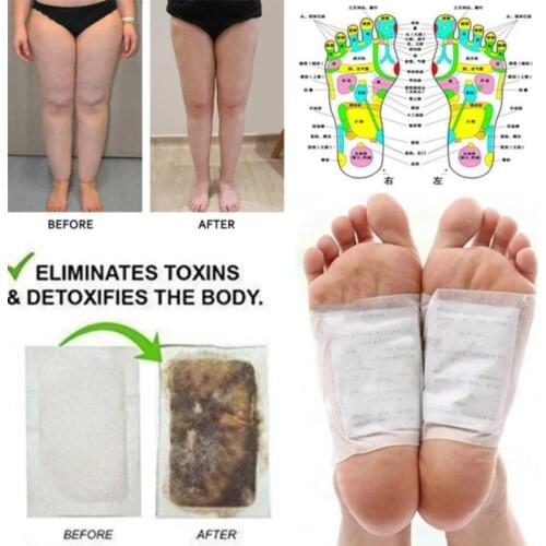 20pcs(10pcs Patches(5 bags)+10pcs Adhesives) Detox Foot Patches Pads Body Toxins Feet Slimming Cleansing HerbalAdhesive