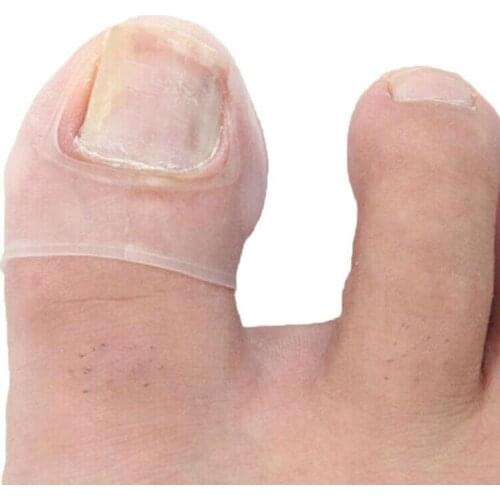 1Pair Silicone Ingrown Toenail Correction Tool Invisible Ingrown Toe Nail Treatment Elastic Straightening Brace Pedicure Tool