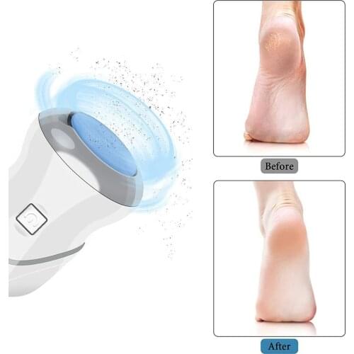 Callus Remover For Feet Rechargeable Heel Scraper For Feet Electric Dead Skin Remover For Feet 2 Speed 3 Grinding Heads