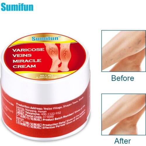 Varicose Veins Treatment Cream Vasculitis Phlebitis Spider Ointment Varicosity Angiitis Removal Herbal Medical Plaster 10g