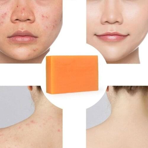 100g Turmeric Essential Oil Handmade Soap Face Wash Removal Acne Treatment Oil Control Moisturizing Whitening Soap Face Care