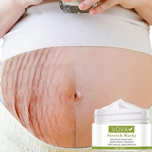 VOVA Removes Stretch Mark Cream To Remove Postpartum Obesity Pregnant Women Repair Anti-Aging Anti-Winkles Firming Body Cream