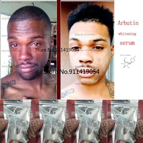 100% Original Whitening Serum Alpha Arbutin Skin Care Permanent Bleaching Serums Dark Lightening Cream Kojic Acid Brightening l