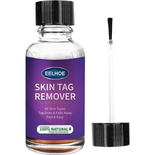 Remover Warts Removal Relief Medical Treatment Meat Corn Skin Flat Wart Antibacterial Liquid Foot Calluses Skin Care Cream