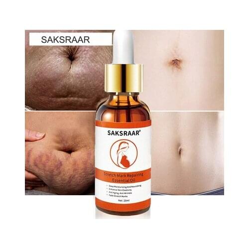 Stretch Marks Remover Essential Oil Skin Care Treatment Cream For Stretch Mark Removal Maternity Slackline For Pregnant Oils