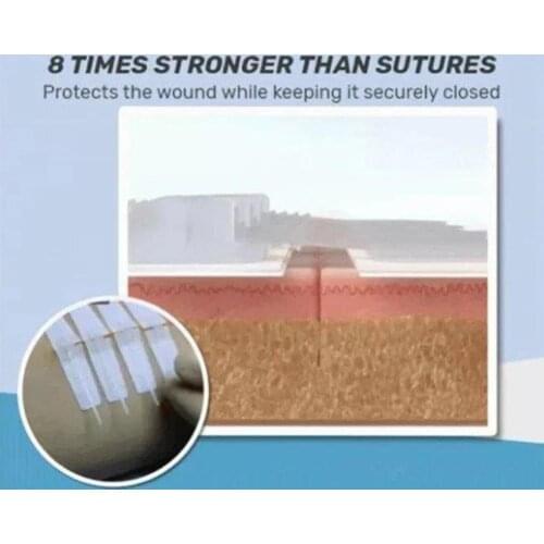 Non-woven Medical Adhesive Wound Dressing Large Band Bandage Aid Tool Care G2P9