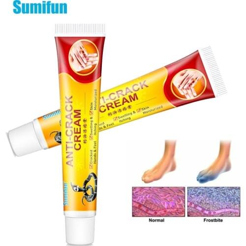 Repairing Moisturizer Cream Anti-chapping For Rough Dry Cracked Chapped Feet Heel Hand Foot Cleft Healing Frostbite Skin Care