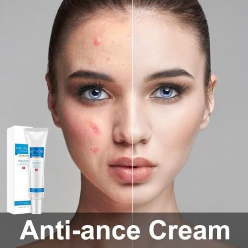 Spot-reducing and repairing cream Acne ointment to remove spots Reduce and lighten spots Dark spot corrector