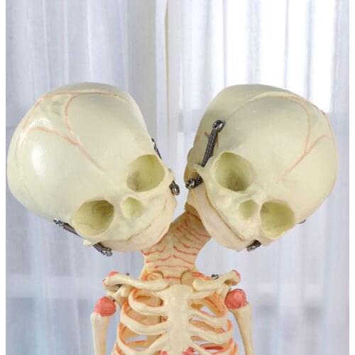 37cm Human Double Head Baby Skull Skeleton Anatomy Brain Display Study Teaching Anatomical Model M5TE