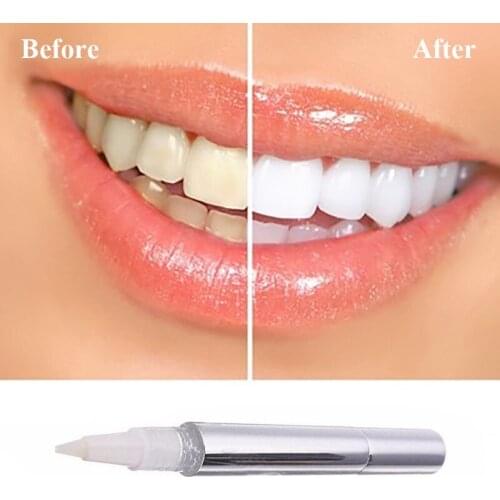 KWOEE Products For Teeth Whitening