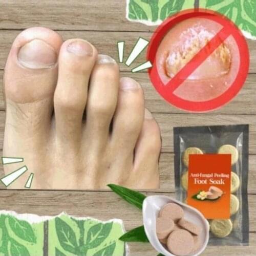10PCS Fungal Nail Detox Foot Soak Long-Term Relief Athletes Foot Skin Cracking Psoriasis Peeling Beriberi Foot Bath TSLM1