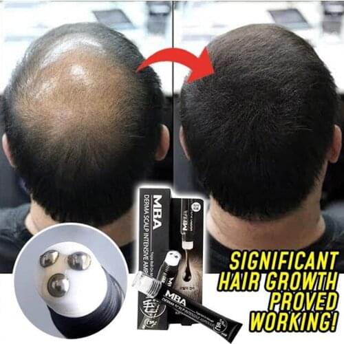Scalp Intense Roll-on Hair Growth Serum Triple Roll Massager Fast Regrow Hair Line Anti Hair Loss Essence