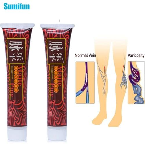 Sumifun 2pcs Varicose Veins Ointment Vasculitis Phlebitis Spider Cream Pain Varicosity Angiitis Removal Medical Plaster D1733