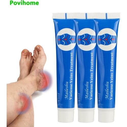 25g Varicose Veins Treatment Gel Varicosity Angiitis Removal Phlebitis legs Veins Ointment Relief Veins Pain Chinese Herbals