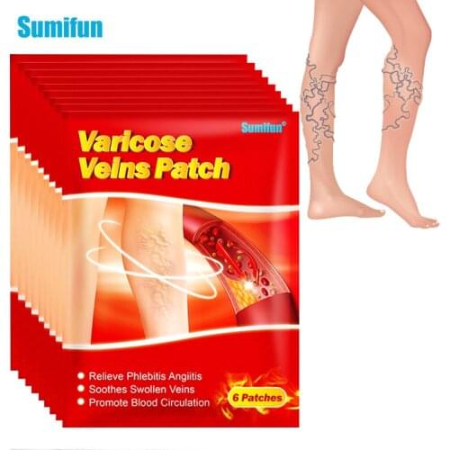 60Pcs Sumifun Varicose Veins Treatment Patch Thigh Phlebitis Vasculitis Spider Removal Pain Relief Herbal Care Medical Plaster