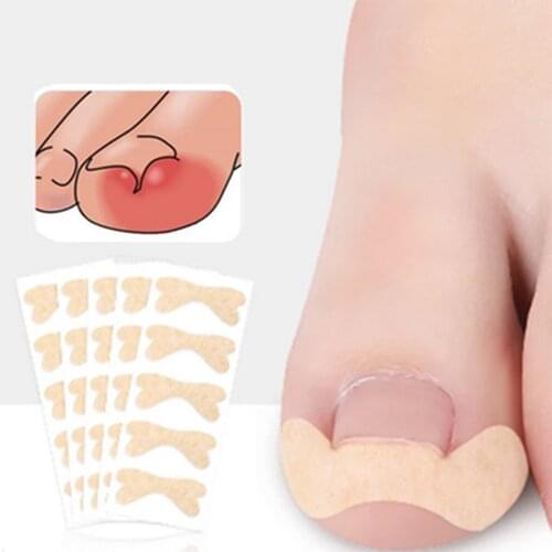 6pcs/sheet Ingrown Toe Nail Corrector Parches Stickers Paronychia Correction Treatment Elastic Sticker Foot Care Pedicure Tools