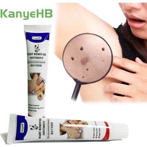 2pcs Skin Tag Remover Cream Armpit Wart Remover Ointment Treatment Genital Herpes Vulva Condyloma Nevus Foot Corn Cream A634