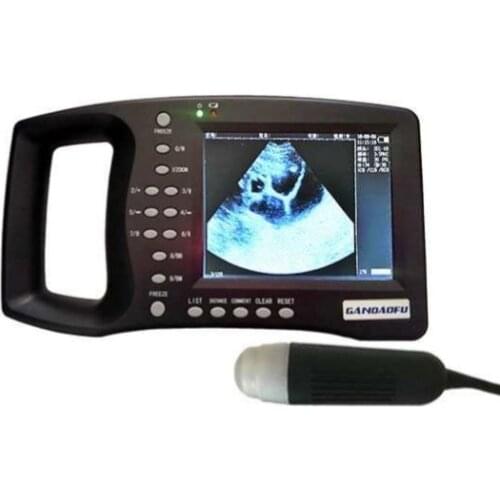 Selvet Digital Endoscope CCTV Cameras