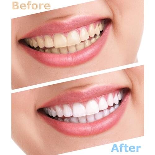 45g Teeth Whitening Oral Care Charcoal Powder Natural Activated Carbon Tooth Plant Whitener Powder Oral Hygiene Remove Stains