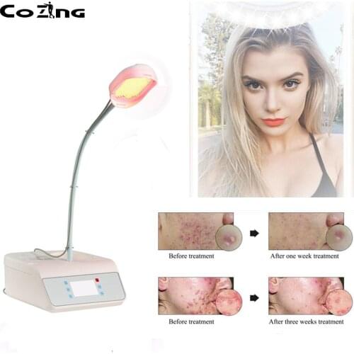Cold Blue Red Light Laser Therapy Led Skin Rejuvenation Beauty Machine