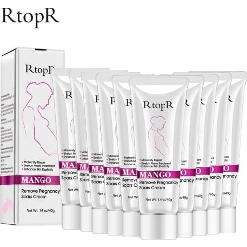 Mango Pregnancy Cream Removes Scars Reduces Wrinkles Protects Pregnant Women Skin Deeply Repairs Skin Increases Skin Vitality