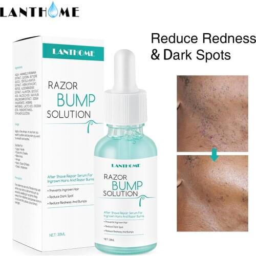 30ml Razor Bump Stopper Ingrown After Shave Reduce Dark Spots Redness Razor Burns Solution Hair Treatment for Men Women