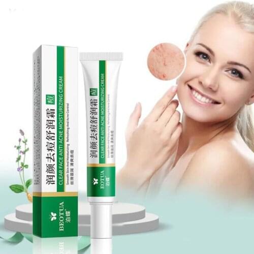 Effective Acne Removal Cream Acne Treatment Fade Acne Spots Oil Control Shrink Pores Whitening Moisturizing Acne Cream Skin Care