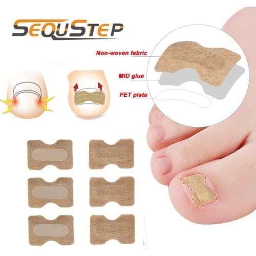 30pcs Ingrown Toenail Correct Sticker Inlay Nail Corrector Anti-roll Nail Toes Protector Correction Foot Care Pedicure Tools
