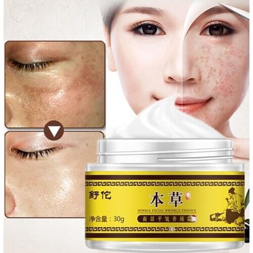 Whitening Freckle Cream Facial Removal Face Care Repair Remove Dark Spots Remover Cream Brightening Treatment