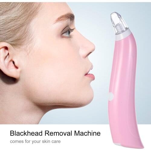 Blackhead Acne Removal Suction Extraction Machine Blackhead Removal Machine Battery Powered Facial Pore Cleanser Skin Cleaner