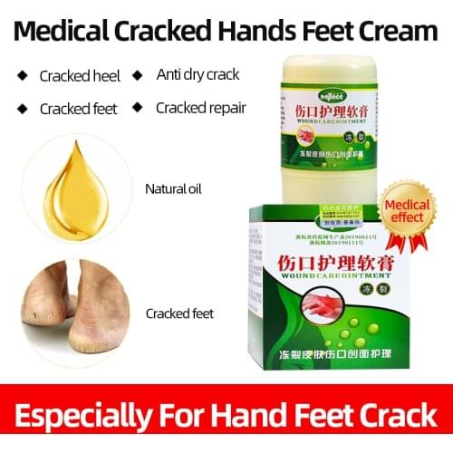 30g Wound Care Ointment Treatment Antifreeze Dry Crack Skin Wound Repair Heel Chapped Peeling Care Plaster