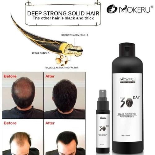 MOKERU Hair Loss Remedies