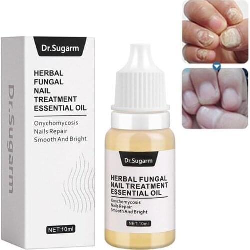 10ml Effective Nail Cream Fungus Removal Nail Treatment Herb Nail Nail Fungus Fungus Foot Against Care Psoriasis Protector F8C0