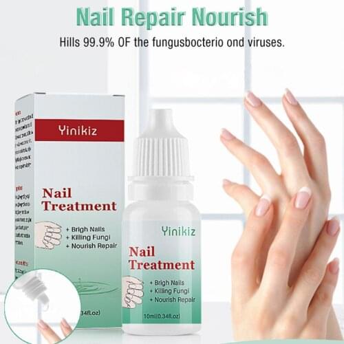 Natural Essence Oil Nail Liquid Repair Treatment Nail Toe Fungus Removal Moisturizing For Nail Foot Care Dropshipping
