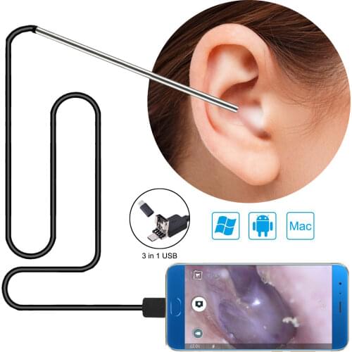 3 in 1 Ear Wax Removal Tool USB Otoscope-Ear Scope Camera In Ear Cleaning Endoscope Visual Ear Spoon 5.5mm Ear pick Otoscope