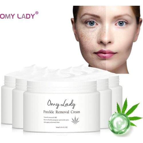 5PCS OMY LADY Freckle Removal Cream Pregnant Spots Melanin Dark Spots Anti Aging Whitening Facial Cream Brightening