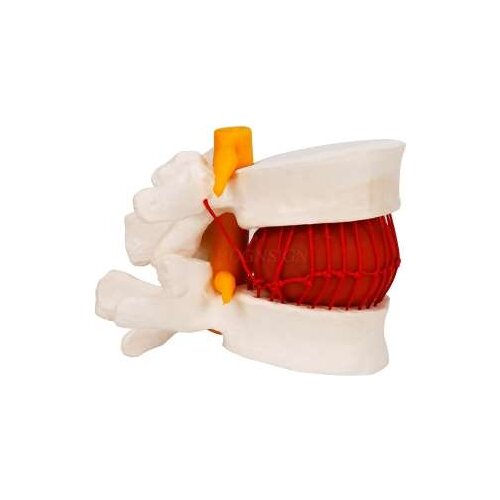 Human lumbar intervertebral disc demonstration model skeletal model Human lumbar spine spine joint model medical
