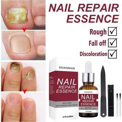 Nail Repair Essence Nail Fungus Treatment for Cracked Rough Fungal Nails Strengthen Damaged Nails of Fingernails Toenails