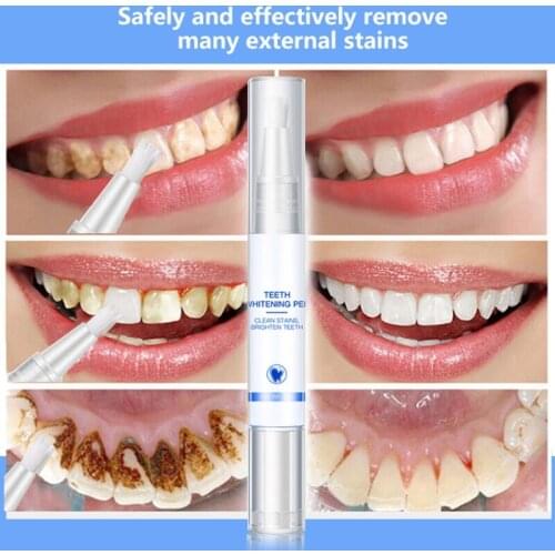 Q1FB 5ml Teeth Whitening Pen Cleaning Serum Plaque Stains Removal Dental Tools Professional Oral Hygiene Brighten Tooth Whitener