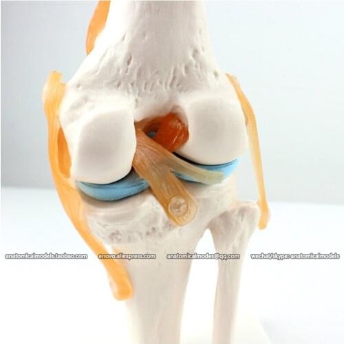 CMAM/12351 Knee joint, Medical Extremities Anatomical Human Model