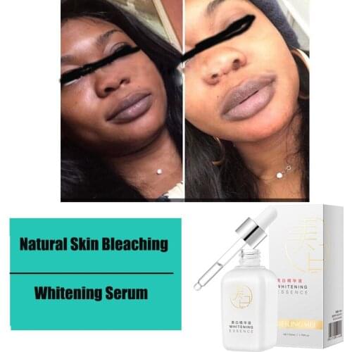 1pcs 50ml Dark Skin Bleaching Cream Whitening Lightening Dark Spot Max Strength SERUM