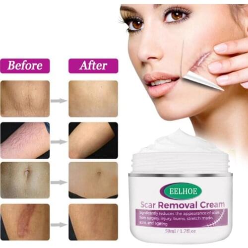 EELHOE 50ml Acne Scar Repair Cream For Strech Mark Scald Caesarean Bump Surgery Scar Removal Cream Treatment Body Care TSLM2