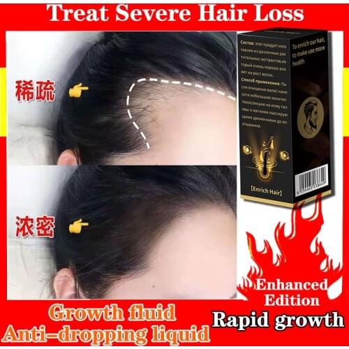 YUKUI Hair Loss Remedies