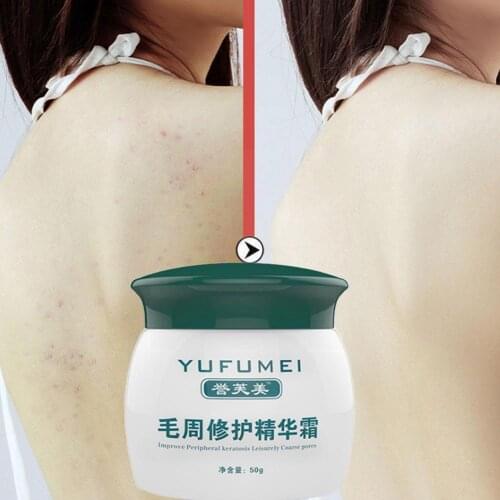 1pcs 50g Curings Keratosis Pilaris Chicken Skin Body And Moisturizing Skin Lotion Nurs Nourishing Repair Skin Essence Care B9I7