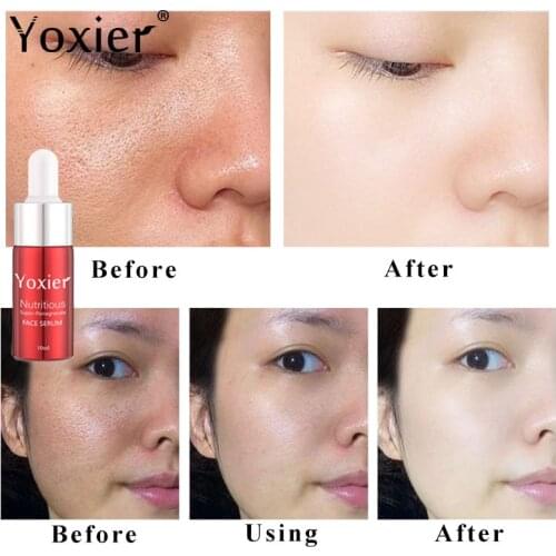 Pomegranate Nourishing Face Serum Anti Aging Lines And Wrinkles Whitening Serum Facial Shrink Pores Essence Whiten Skin Care