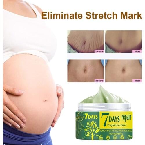 7 Days Stretch Mark Repair Cream Maternity Obesity Pregnancy Skin Postpartum Stretch Scar Body Marks Remover Smooth Skin Care