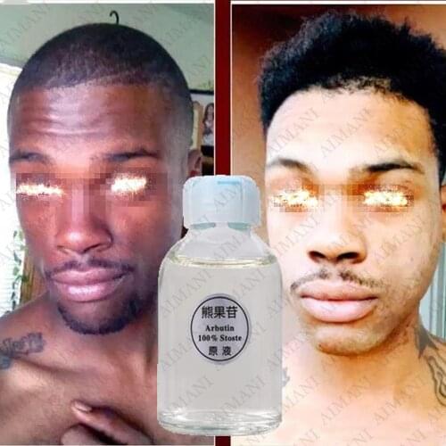 30ml Whitening Serum Natural Alpha Arbutin Skin Care Permanent Bleaching Serums Dark Lightening Cream Brightening Skin Products