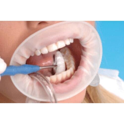 Dental Ivoclar OptraGate 3D Lip and Cheek Retractors White Regular 7.0cm